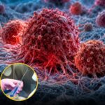 Câncer metástico é erradicado com apenas duas doses de um novo tratamento